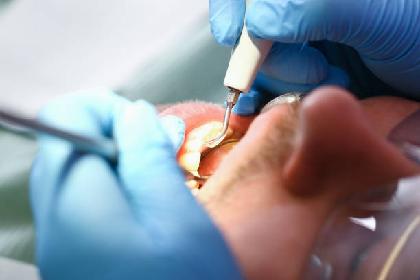 Best Emergency Dental Care for Broken or Chipped Teeth in Hobbs, NM
