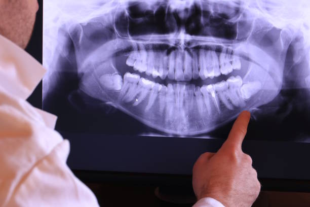 Best Emergency Denture Repair in Hobbs, NM