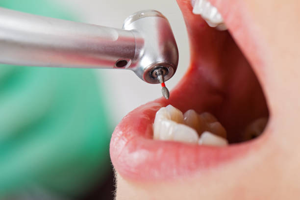 Best Emergency Treatment for Dental Infections or Abscesses in Hobbs, NM